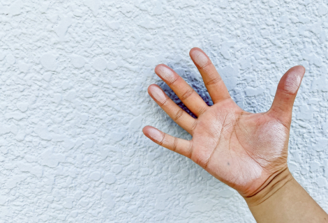 手で触ると白い粉が付く（チョーキング現象）